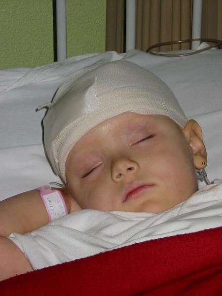 4-13.jpg - After the first operation to remove her shunt and place an external one. Resting peacefully.